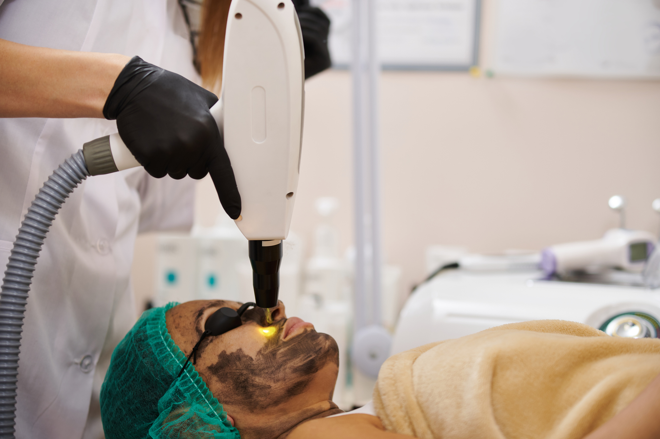 Laserbehandlung gegen Akne 1 iStock 1288395645