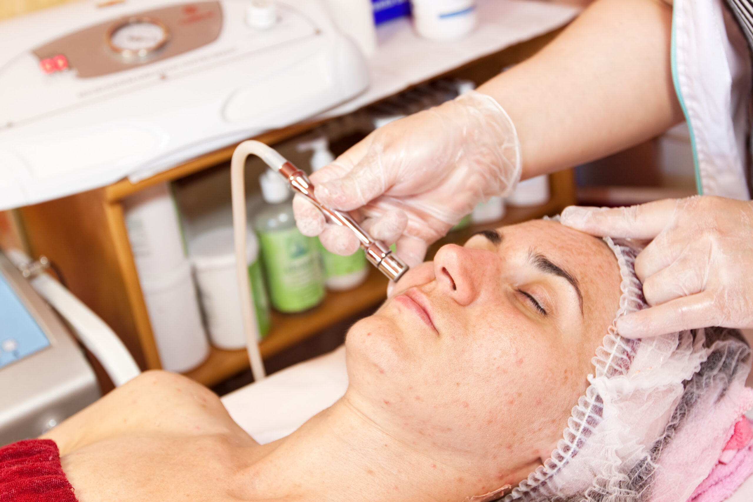 Laserbehandlung für Rosazea 3 iStock 182856831 scaled