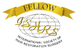 Μεταμόσχευση Μαλλιών 1 Untitled design 80 e1732188455733